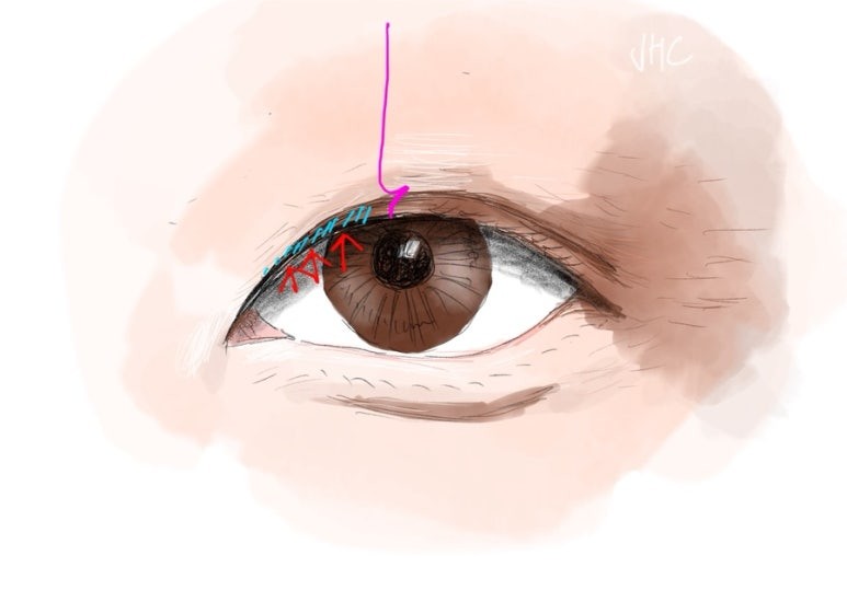 얇은 인아웃라인 기준 일러스트