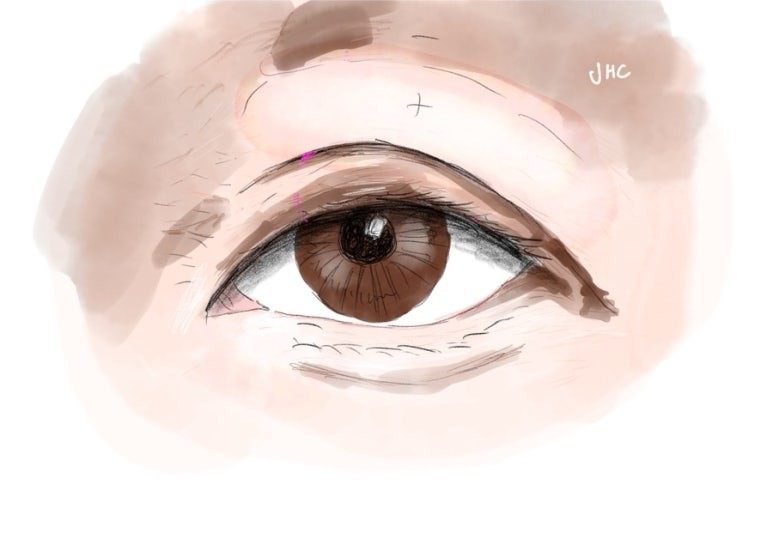 두꺼운 앞머리 쌍꺼풀 일러스트