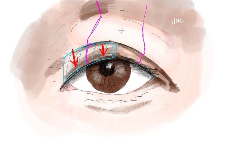 속눈썹 각도 차이 일러스트